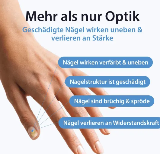 Acetocaustin Nagelpflege & Reparatur Lösung 9 ml