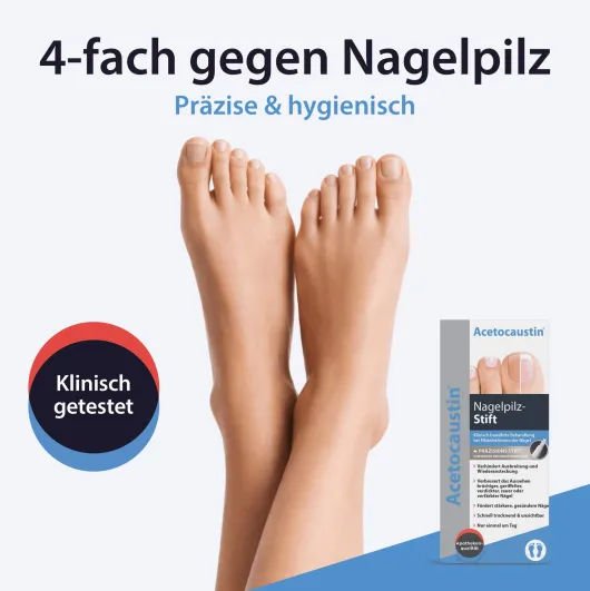 Acetocaustin Nagelpilz Stift 4 ml