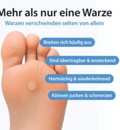 Acetocaustin 20 Warzenpflaster