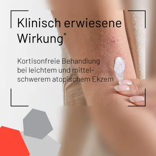 Alfason Ekzem Creme 60 G
