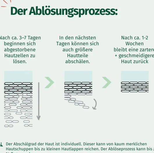 Allgäuer Latschenkiefer Hornhaut Entferner Maske cremig 1 Stück
