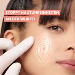 Avene Cleanance Comedomed Anti Unreinheiten Konzentrat 30 ml
