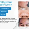 Benevi Hydroderm Gesichts-Reinigung 125 ml