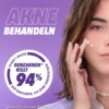Benzaknen 10% Gel 15 G