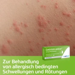 Cetirizin Axicur 10 mg 20 Filmtabletten
