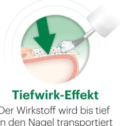 Ciclopoli gegen Nagelpilz 6,6 ml