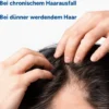 Ducray Anaphase Neoptide Serum bei Haarausfall 2 x 50 ml