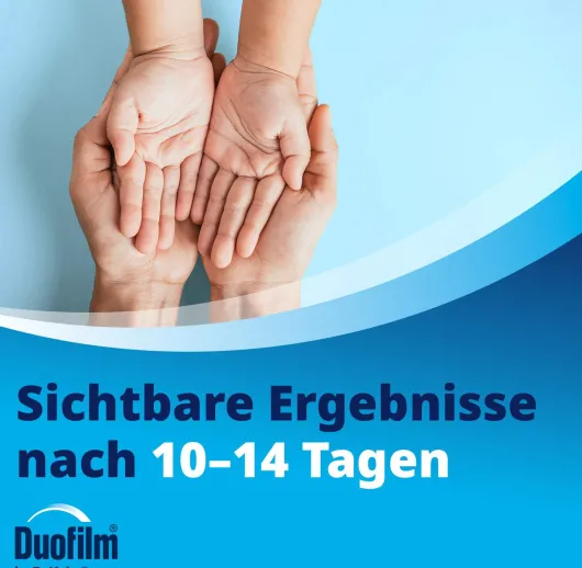 Duofilm Vereisungsspray gegen Warzen 50 ml