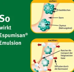 Espumisan Emulsion 3 x 30 ml