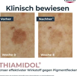 Eucerin Anti-Pigment Korrekturstift 1 Stück