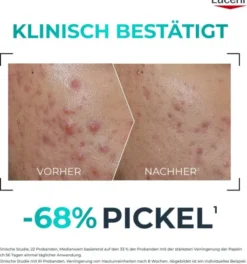 Eucerin DermoPure Clinical Probiom 8 Routine-Set 1 Stück