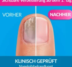 Excilor Intensiv Lack Gegen Nagelpilz 30 ml