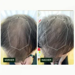 Hair Growth-Routine Set Für Männer bei Haarausfall 1 Stück