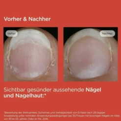Isdin Si-Nails Nagelhärter Stift 2,5 ml