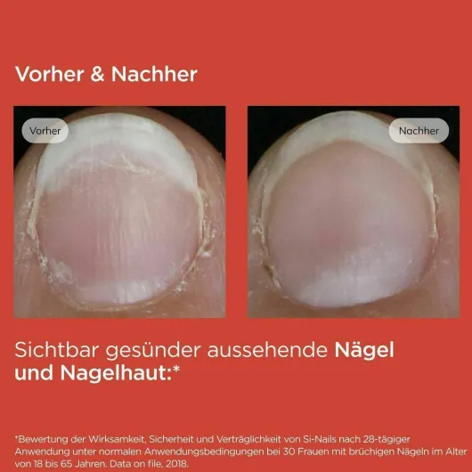 Isdin Si-Nails Nagelhärter Stift 2,5 ml