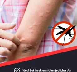 Juckstopp Kühlgel Ensbona Tube