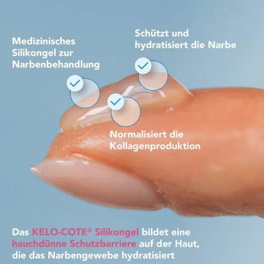 Kelo-Cote Kids Silikon Narbengel 6 G