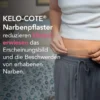 Kelo-Cote Silikon-Narbenpflaster Kaiserschnitt 1 Stück