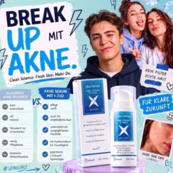 KES Akne Serum 30 ml