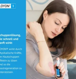 Loyon bei Schuppigen Hauterkrankungen 50ml Lösung
