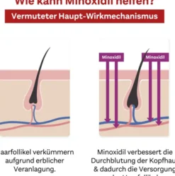 Minoxidil Doppelherz Pharma 20 mg je ml 3 x 60 ml Lösung für Frauen