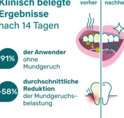 Nupure probadent MAX N44 und Vitamin D3 28 Beutel