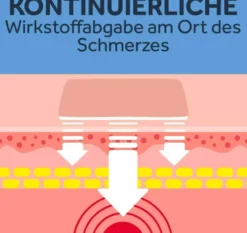 Nurofen 24-Stunden Schmerzpflaster 200 mg 2 Stück
