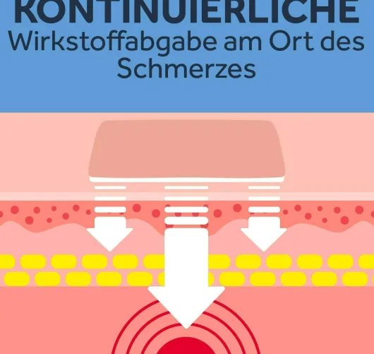 Nurofen 24-Stunden Schmerzpflaster 200 mg 2 Stück