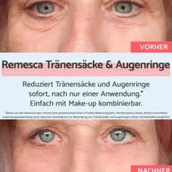 Remescar Tränensäcke und Augenringe Augencreme 8 ml
