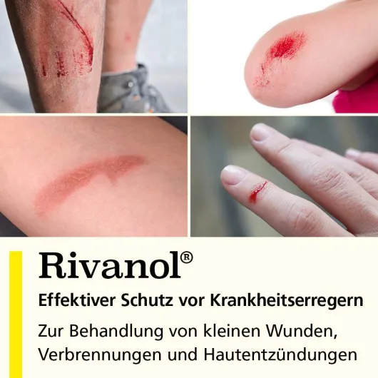 Rivanol Lösung 0,1% 300 ml
