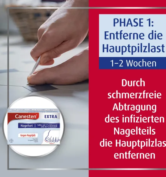 Sparset Canesten Extra Nagelset + Canesten Extra 20 g Creme