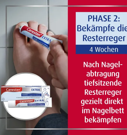 Sparset Canesten Extra Nagelset + Canesten Extra 20 g Creme