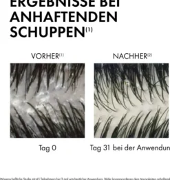 Vichy Dercos Anti-Schuppen Shampoo für fettige Kopfhaut 200 ml