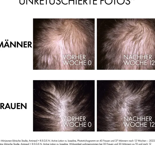 Vichy Dercos R.E.G.E.N. Booster 90 ml