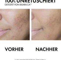 Vichy Normaderm Phytosolution Anti Unreinheitenpflege mit 2 Fach Wirkung 50 ml