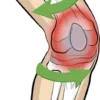 Vital Komfort Kniebandage PatellaTec Gr. M