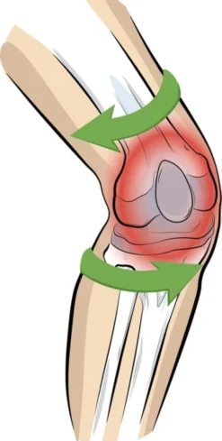 Vital Komfort Kniebandage PatellaTec Gr. M