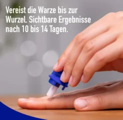 Wartner Warzenentferner 50 ml Spray