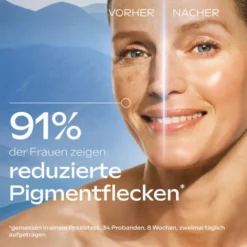 Weleda Anti-Pigmentflecken Bright Serum 30 ml