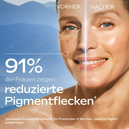 Weleda Anti-Pigmentflecken Bright Serum 30 ml