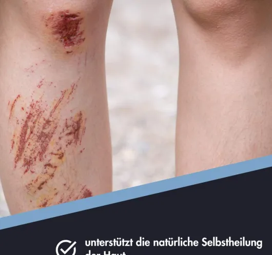 Zinksalbe Ensbona 75 ml